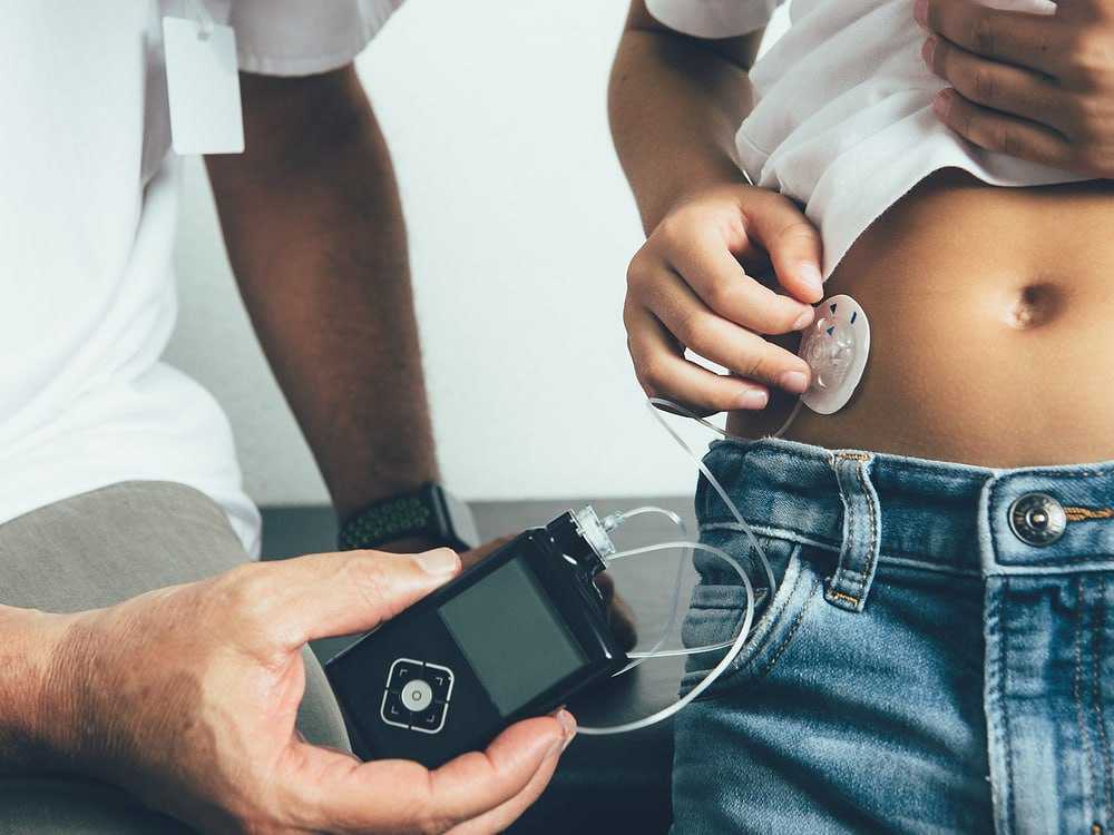 Інсулінові помпи для дітей: визначено переможця тендеру